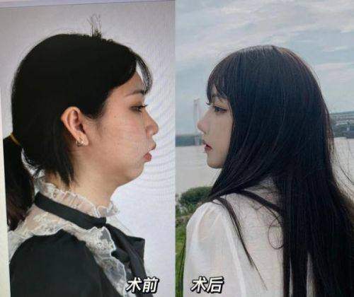 选择医院的注意事项