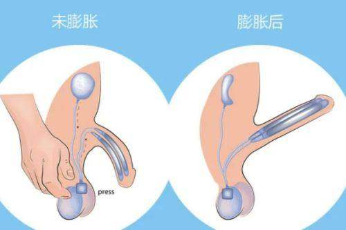 韩国好手艺私密整形医院