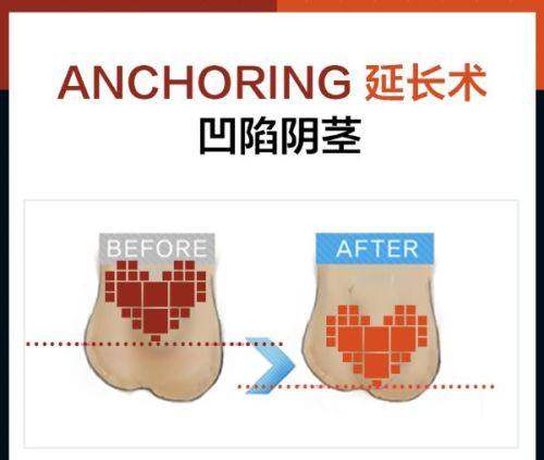 眼部项目价格优势