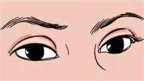眼部整形项目