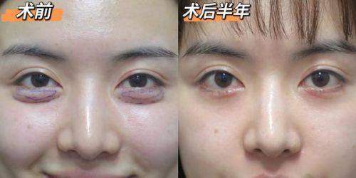 选择惠州伊丽莎白整形美容医院的理由