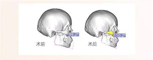 六、重 医 大附一院整形美容科在重庆缩胸三等甲整形医院排名中的实力体现
