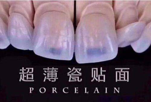 二、宁波海曙健雅口腔——种植牙的优质之选