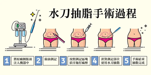 三、武汉美莱整形医疗的丰臀医生排名亮点