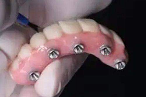 4. 潍坊华贝口腔树脂补牙之良好环境优势