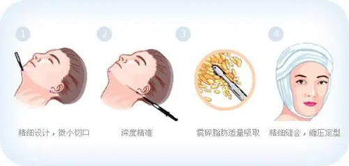 三、上海联合丽格医疗美容门诊部范荣杰手术质量