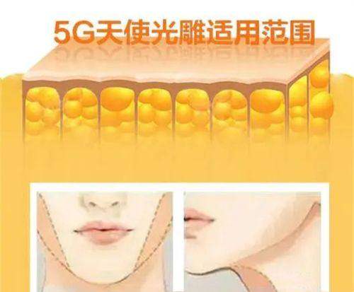 五、东莞整形医院排名前十的项目价格微调