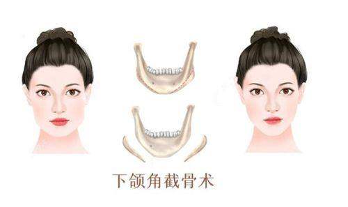 深圳伽美贝拉医疗美容（海上世 界店）正规吗？