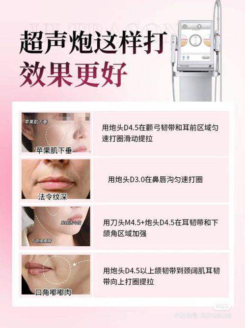 深圳伽美贝拉医疗美容（海上世 界店）地址电话及营业时间：
