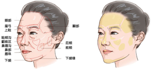 大连爱德丽格刘志刚离职？2025最新辟谣：眼修复手术排期已至7月，技术获金刀奖认证
