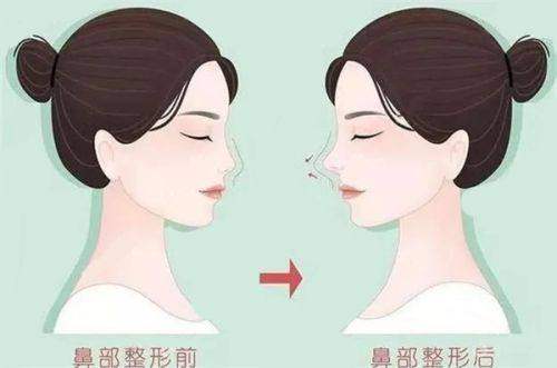 成都美容整形医院正规吗？成都TOP3整形机构对比，价格表+医生团队大揭秘