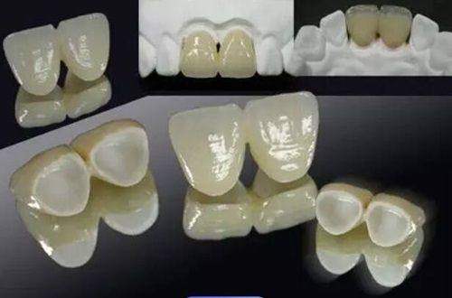 达州绮云口腔医院正规吗？答案是肯定的