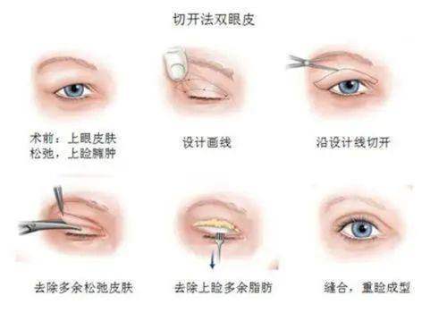 武汉同济医学院医院怎么样?专精团队技术优、价格透明,隆胸隆鼻口碑超棒!
