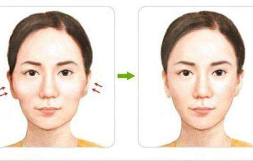 十、广州壹加壹医疗美容医院：年轻友好型机构