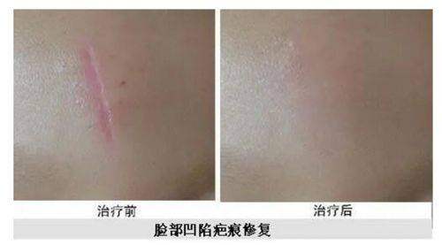 二、成都谁做假体隆胸手术好?赵敬国:东方体型定制骨干医生,手感与形态双优