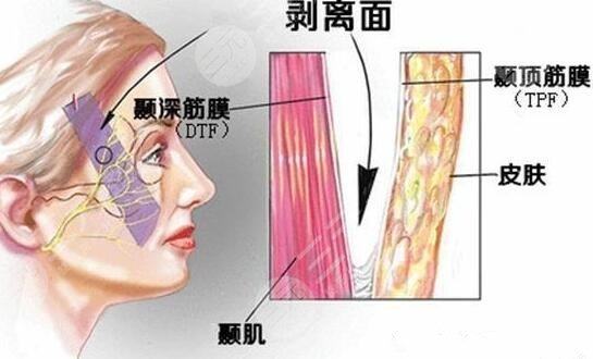 做了热玛吉抗衰老之后需要注意什么?